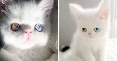 Heterochromia